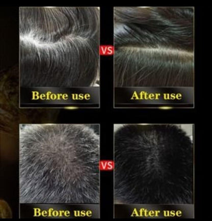 3 in 1 Black Hair Dye Shampoo - Buy 1 Get 1 FREE